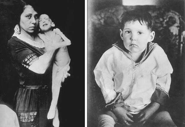О роли монетки в открытии инсулина, о нобелевском лауреате из клана Маклаудов, о ненависти и приоритете рассказывает наш сегодняшний выпуск рубрики Как получить Нобелевку