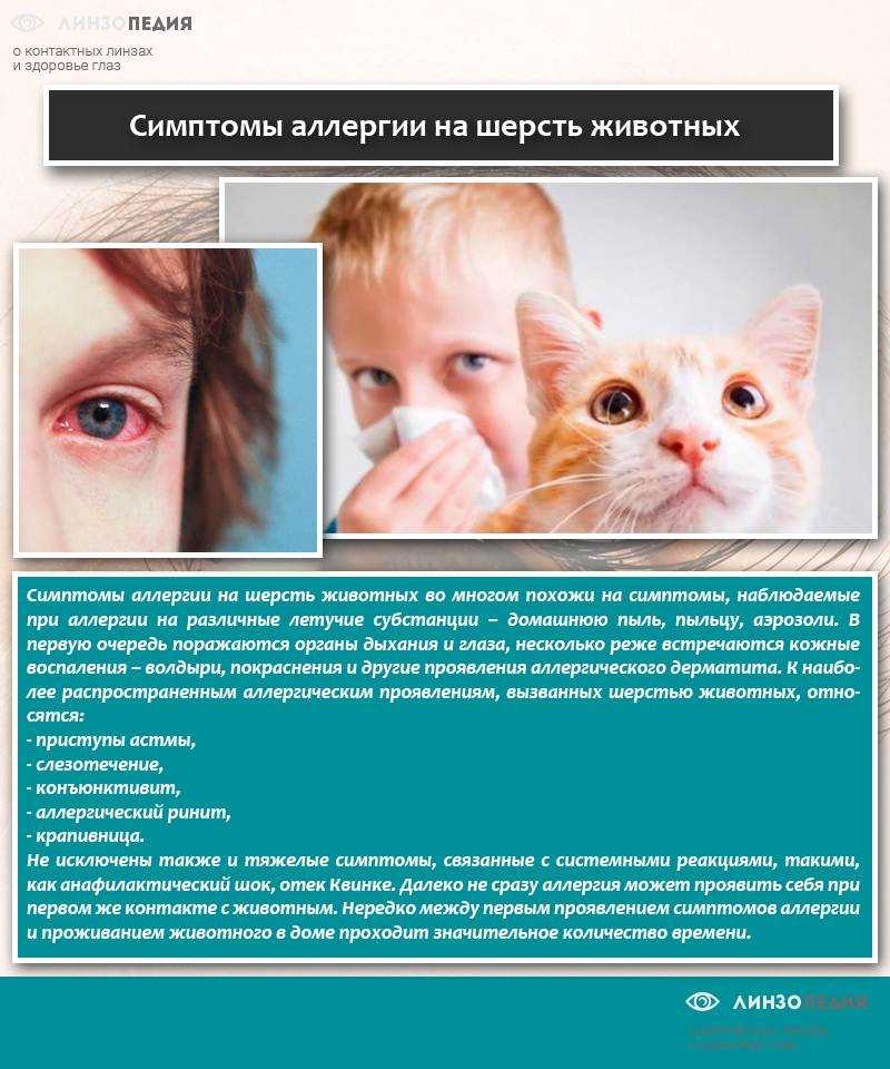 Аллергия