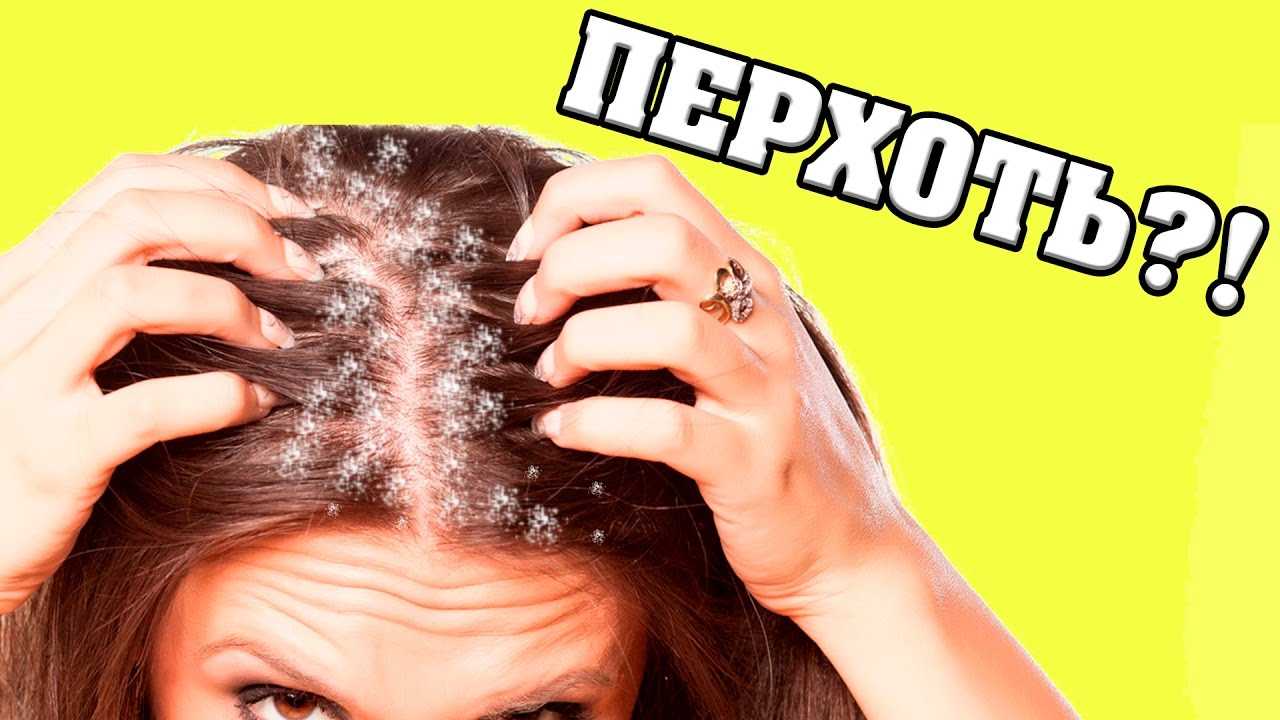 Безсульфатные шампуни против перхоти – список лучших