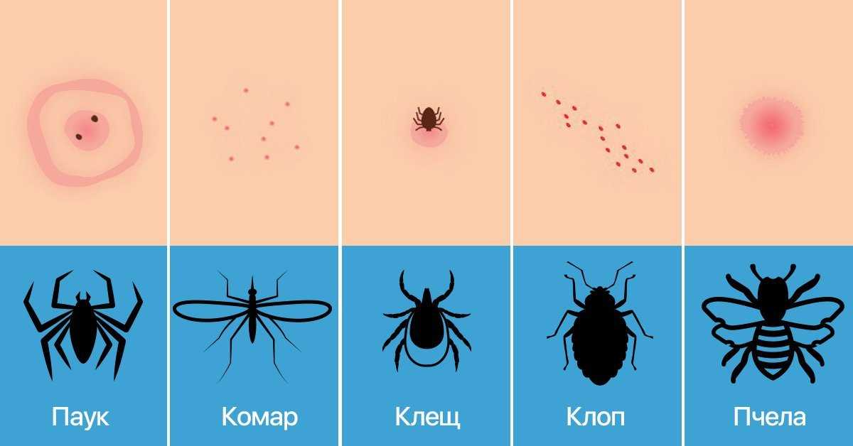 Почему одних людей комары кусают, а других нет